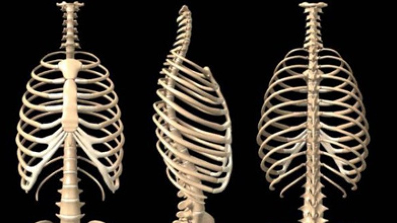 مرض تشوه النخاع الشوكي يهدد حياة المواليد في الجزائر