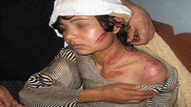 L’ONU déplore la hausse des violences contre les femmes à travers le monde