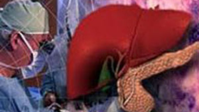 28 جويلية يوما عالميا لالتهاب الكبد الفيروسي