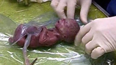 Avortements clandestins dans des villas et appartements en contrepartie de 30 millions de centimes