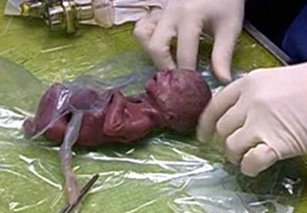 Avortements clandestins dans des villas et appartements en contrepartie de 30 millions de centimes