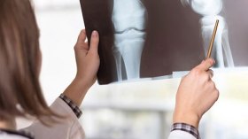 هشاشة العظام تنخر 40 من المائة من الجزائريات