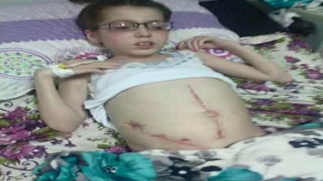 زبيدة في حاجة للعلاج بالخارج بعد تعرضها لتعقيدات صحية