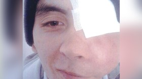 يعقوب في حاجة إلى عملية جراحية مستعجلة في تركيا