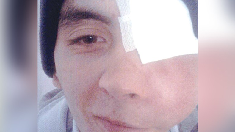 يعقوب في حاجة إلى عملية جراحية مستعجلة في تركيا