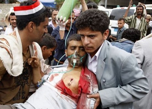 Yémen: 22 morts dans les violences à Sanaa