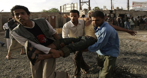 Yémen : 96 morts et 300 blessés dans un attentat à Sanaa