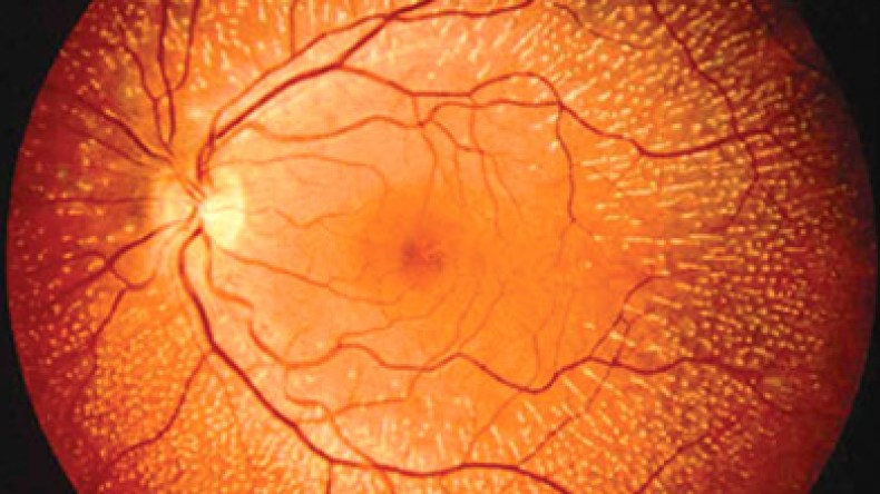 مليون مصاب بالسكري في الجزائر مهددون بالعمى