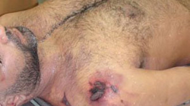 عائلة الصحفي زكرياء العشري تنفي مرضه وتراسل محكمة العدل الدولية