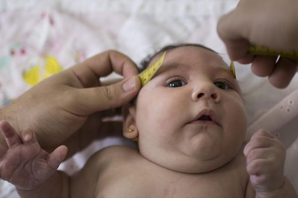 Boudiaf : «Les laboratoires étrangers propagent les rumeurs du Zika en Algérie»
