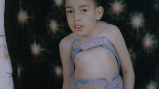 مستشفى الإستقلال يتعهد بالعلاج التام للطفل زين الدين