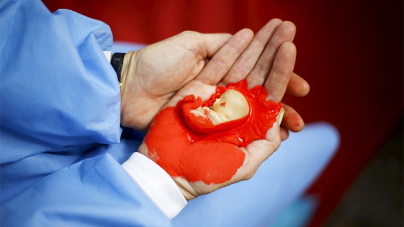 شروط الإجهاض وضمانات المجانية.. قبضة حديدية بين النواب والحكومة!