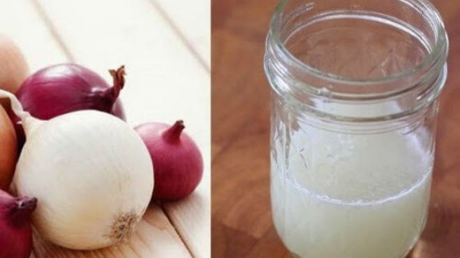 تعرفي على الخصائص المدهشة لعصير البصل؟