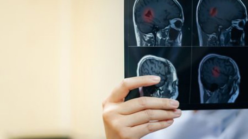 مرضى التصلب اللويحي يستفيدون لأول مرة من دواء فموي بدل الحقن