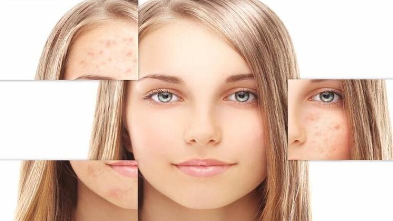 للقضاء على تصبغات الجلد عليك بهذه المكونات؟