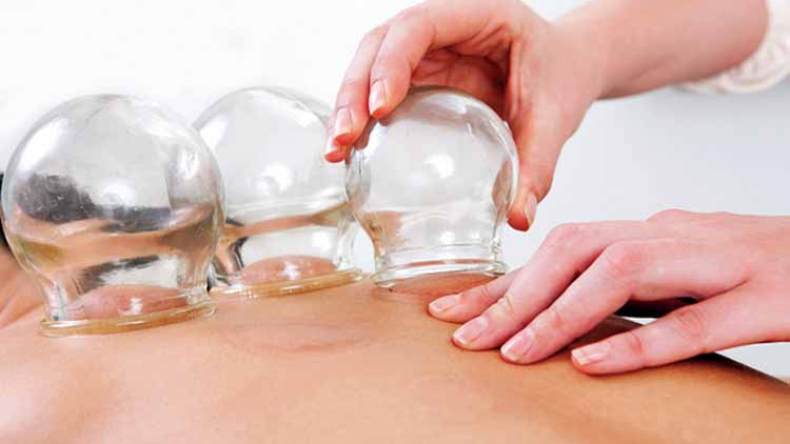 دكاكين الحجامة تنتشر في كل مكان