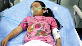 “الطابونة” سبب 60 بالمائة من حروق الأطفال أيام العيد