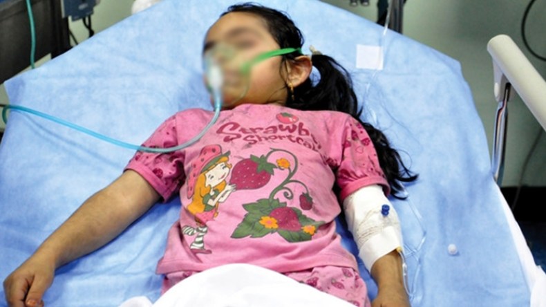 “الطابونة” سبب 60 بالمائة من حروق الأطفال أيام العيد