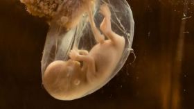 هل زيادة الماء حول الجنين خطر في الشهر التاسع؟