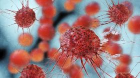 علامات تدل على السرطان.. إياك أن تتجاهليها؟