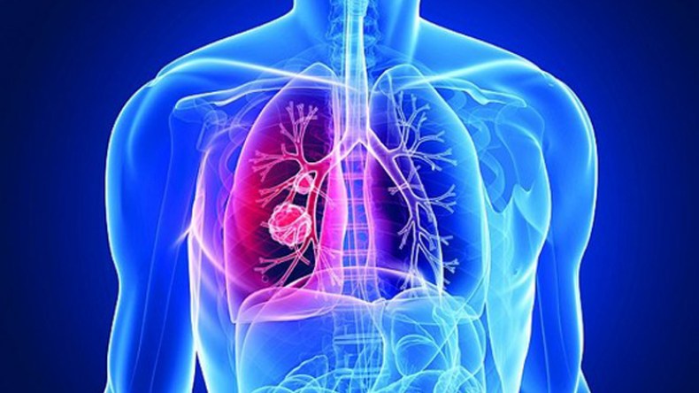 دليل جديد للتكفل بمرضى السل في الجزائر