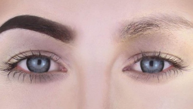 الرموش والحواجب الخفيفة دليل الإصابة بهذا المرض!