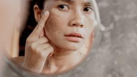 حماتك قد تسبب لك الشيخوخة المبكرة!