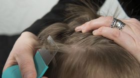 القمل يغزو رؤوس التلاميذ ومدارس تتستر على العدوى