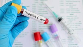 تسجيل 151 حالة إصابة بمرض التهاب الكبد الفيروسي