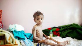 اليونيسيف: طفل يموت كل 10 دقائق في اليمن!