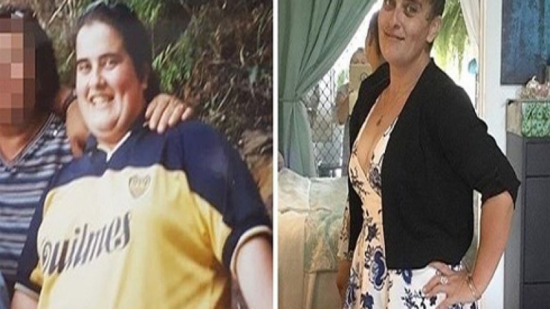 هكذا فقدت فتاة أسترالية 70 كيلوغراما من وزنها؟!