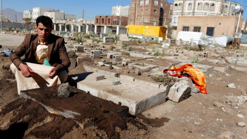 وفاة توأمين ملتصقين في اليمن