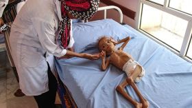 نخسر “الحرب ضد المجاعة” في اليمن