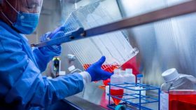 «Le coronavirus est sorti d’un laboratoire chinois avec de l’ADN de VIH», affirme un prix Nobel de médecine