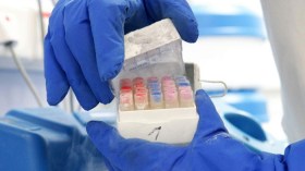 تجميد البويضات.. خطة السوريات لمواجهة العنوسة!