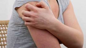 المرض الجلدي الأكثر إحراجا كيف يمكن محاربته؟