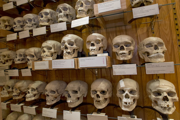 Paris Musée de l’Homme Counts 535 Skulls Of Algerian War Resisters
