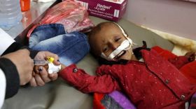 صور مفجعة عن حرب اليمن المنسية