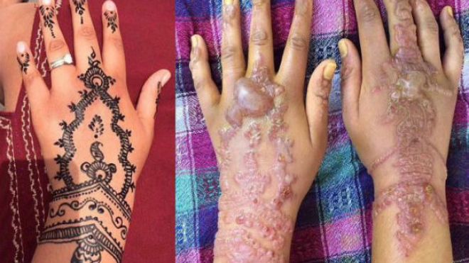 حناء سوداء مسربة من ليبيا تسبب التسمم والوفاة!