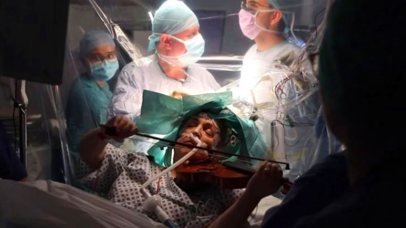 شاهد.. مريضة تعزف الكمان أثناء عملية استئصال ورم في المخ