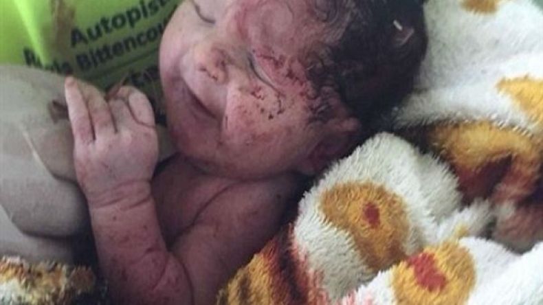 طفلة تنزلق من رحم أمها في حادث مرور مروّع!