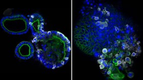 فيروس كورونا أكثر شراً مما توقع العلماء
