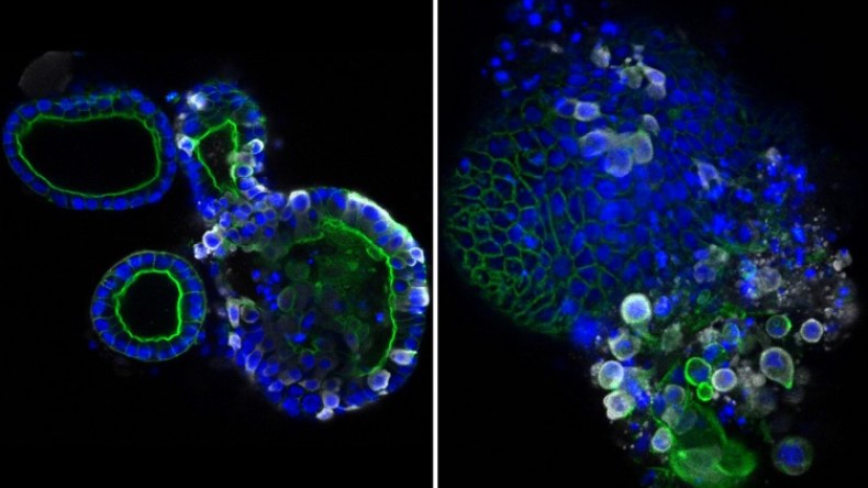 فيروس كورونا أكثر شراً مما توقع العلماء