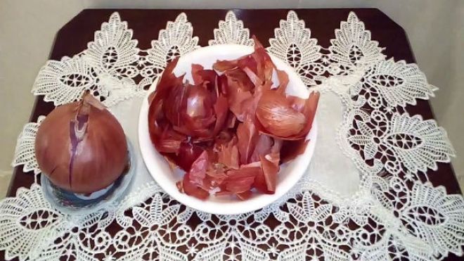 إياك والتخلص من قشور البصل بعد الآن؟