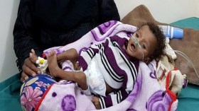 56 مليون شخص بالعالم بحاجة للغذاء