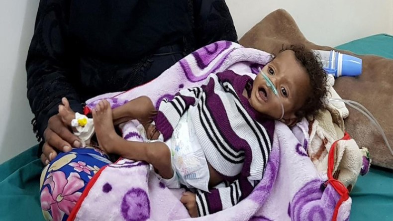 56 مليون شخص بالعالم بحاجة للغذاء