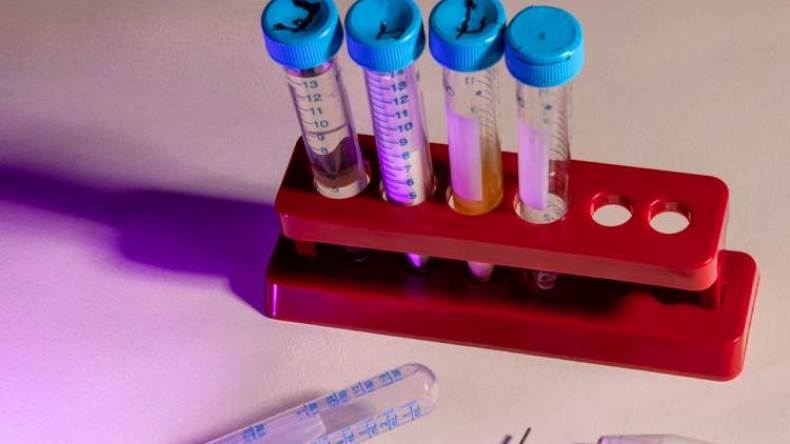 هكذا سيختار العلماء أفضل لقاح لكورونا لاستخدامه