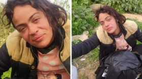 فتاة مريضة عقليا وحامل تلهب مواقع التواصل