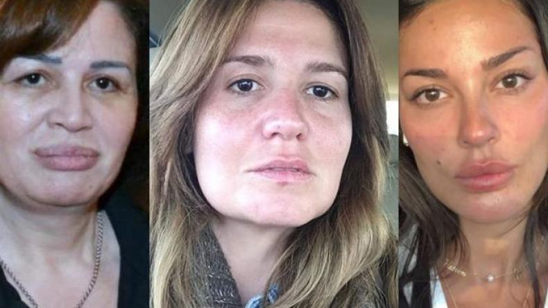 بالصور.. الحقيقة الصادمة لبشرة بعض النجمات بدون ماكياج!