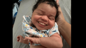 ما حقيقة صورة مولود بأسنان ناصعة البياض مثل البالغين